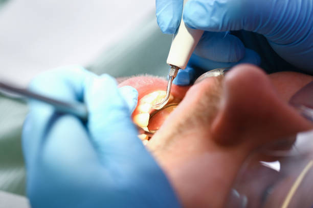 Best Root Canal Emergency Dentist  in Shively, KY