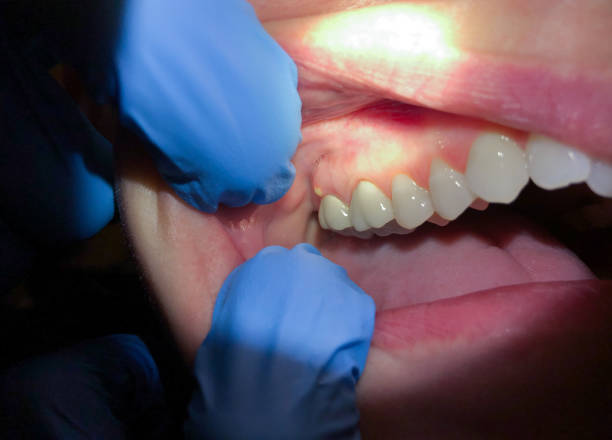 Best Urgent Tooth Repair  in Shively, KY